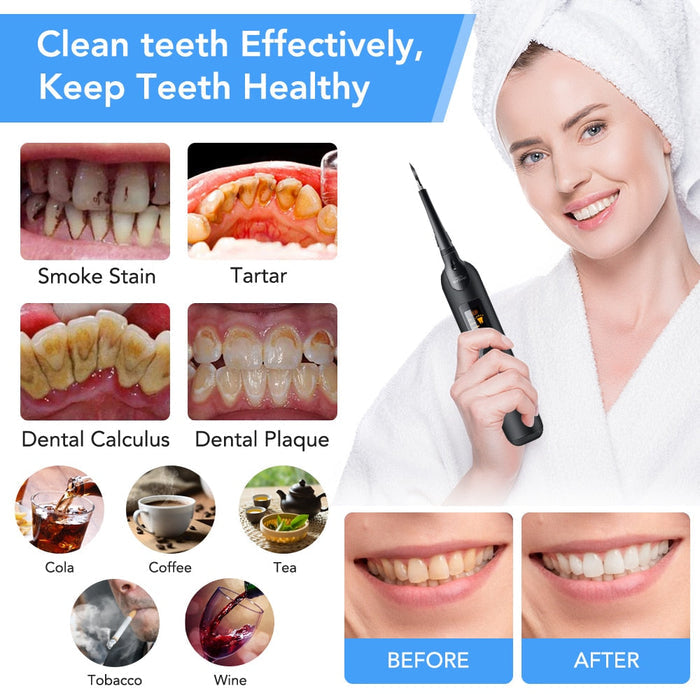 Dental Plaque Remover/Scraper-TopOnlineBargains.Com