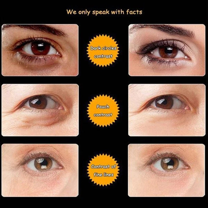 Eye Cream-TopOnlineBargains.Com