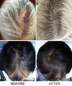 Hair Growth Helmet-TopOnlineBargains.Com