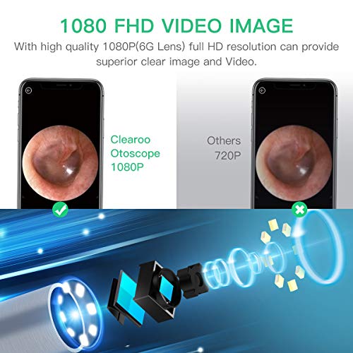 Wireless Ear Otoscope-TopOnlineBargains.Com