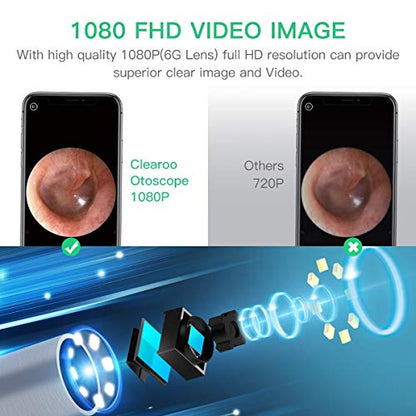Wireless Ear Otoscope-TopOnlineBargains.Com