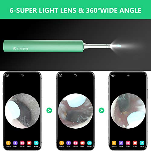Wireless Ear Otoscope-TopOnlineBargains.Com