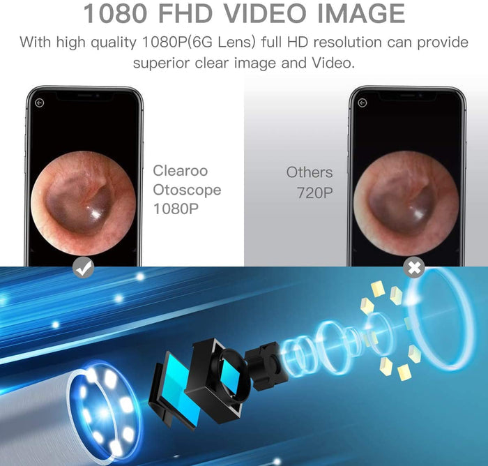 Wireless Ear Otoscope-TopOnlineBargains.Com