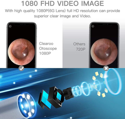 Wireless Ear Otoscope-TopOnlineBargains.Com