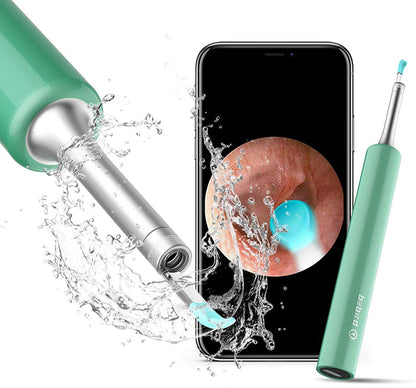 Wireless Ear Otoscope-TopOnlineBargains.Com